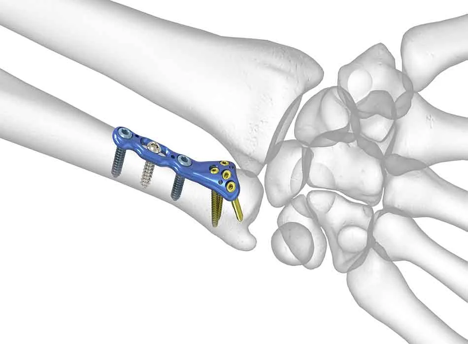 Medical Solution 0331