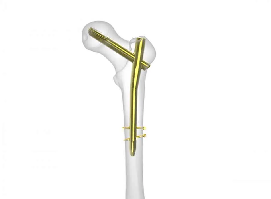 Medical Solution 0332