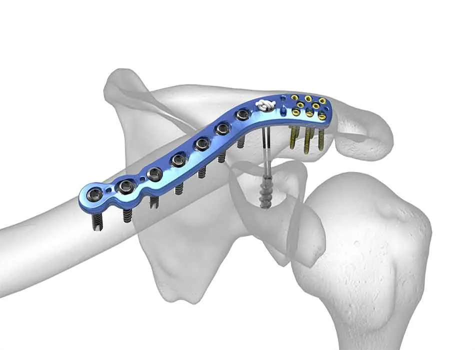 Medical Solution 0333