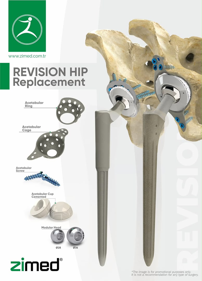 Medical Product 036