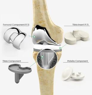 Zimed Total Knee Ps Small